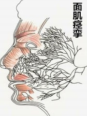 医学微观:面肌痉挛