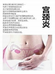 医学微观:宫颈炎